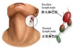 �ܰͽ��״��ԭ�� ����Щ����