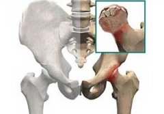 �ɹ�ͷ�����Ĳ��� ʲô���¹ɹ�ͷ����