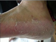 �ǻ��ͽ�����ô���� ҩ����͸�����Ʒ�