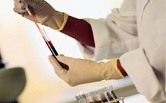 Ѫ�ͳ�ʶ o��Ѫ��a��Ѫ���ĺ�����ʲôѪ��