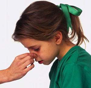 经常流鼻血是怎么回事 简单止血方法介绍