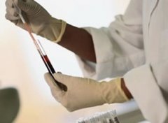 ���ʪ��������ֵ��ע������