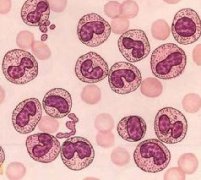 ���ϸ��ƫ�ߵ�ԭ�� ���ϸ��ƫ������ô����