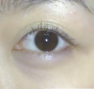 ����ȥ���۴� ȥ���۴�����Ч����