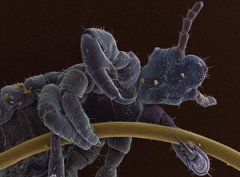 ͷ�ϳ�ʭ����ô�� ͷ�ϳ�ʭ�ӵĴ����취