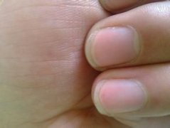 ��ָ������ô����� ʲô����Ļ�ָ��