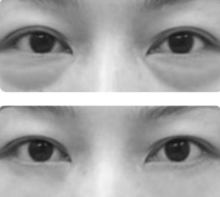 ��ôȥ�۴� ����ȥ�۴�����ȥ�ĺ�