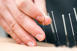 针灸减肥有效吗