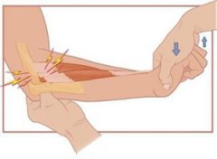 ʲô�������� ��������ʲô֢״����