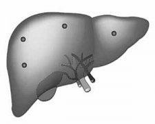 ��Ӳ��������֢״ ����Щ֢״