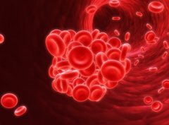 ѪС��ѹ��ƫ�ߵ�ԭ�� ����Щԭ��