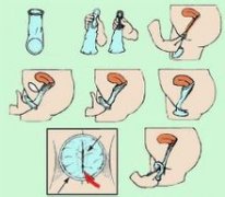 ���Խ���������Ů�ñ����� ��������ô��