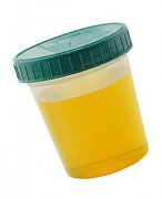 ��Ƶ�ԭ�� Ů���������Щԭ��