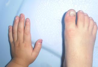 ��ָ������ô����� ʲô���³��ֻ�ָ��