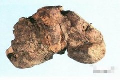 �����ߵĹ�Ч����Щ �����ߵ�ע������