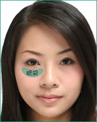 如何有效去除眼袋及黑眼圈 去眼袋最有效的方法