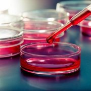 Ѫ֬����֢״����Щ Ѫ֬����֢״����