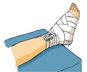 �μ��Լ�����Ѫ�ܹ����� �μ�����Ѫ