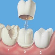 ����������ʲôΣ�� ��������Ӧ��ע��ʲô