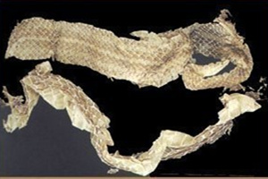 蛇蜕的药用价值