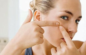 额头上长粉刺怎么办 额头上长粉刺的处理办法