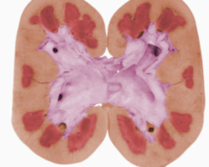 ������˥��֢״