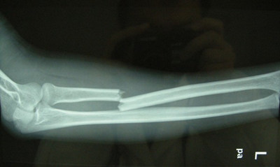 ���������ȷ��ȡ���ȴ�ʩ ����ʱ���Ȳ���������