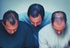 ֬�����ѷ���ô���� ���Ƶķ�������Щ