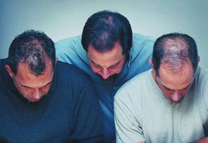 ֬�����ѷ���ô���� ���Ƶķ�������Щ