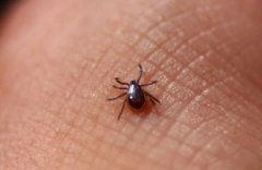 ���ҧ��֢״����ע������