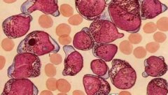 �ܰ�ϸ������ƫ�� ������ϸ���ٷֱ�ƫ��