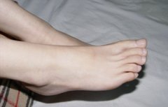 ������Ƥ��ô�� ���ƽ���Сƫ��