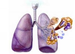 ����֧�����׵Ĳ���֢ ����Щ����֢