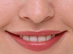 ��ǻ��ƽ̦޺����Щ֢״����