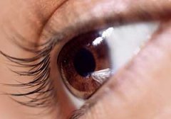 �۾�ɢ�����κ��� ��ô����ɢ��