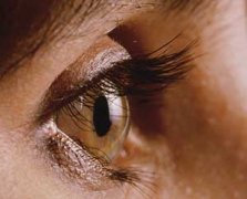 ɢ���۵�֢״���� ʲô��ɢ����