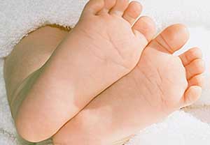 宝宝体质差怎么办