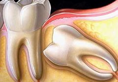 �����ǳݵ�Σ�� �ǳ�Ҫ��Ҫ�ε�