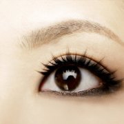 �۾���Ѫ����ô���� Ϊʲô���۾���Ѫ