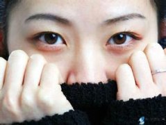 �������и���˵ĺ���Ȧ