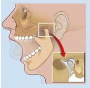 �ſ����ѵ�ԭ�� Ϊʲô���ſ�����