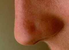 ʲô�Ǳ����� �����������Ʒ���