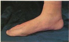 Ԥ����ƽ���γɵ���������