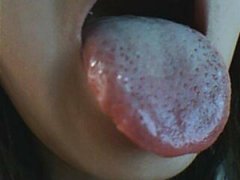 ������Ѷ������÷���ֻ� Ů��÷��������֢״