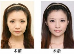 ������ǰ��Ա������� ������Ч���Ա�ͼ