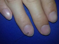 Ϊ������ָ�����а׵�����ô����